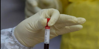 Over 90% of the times Plasma therapy has proven to be effective against Coronavirus Mediabeast