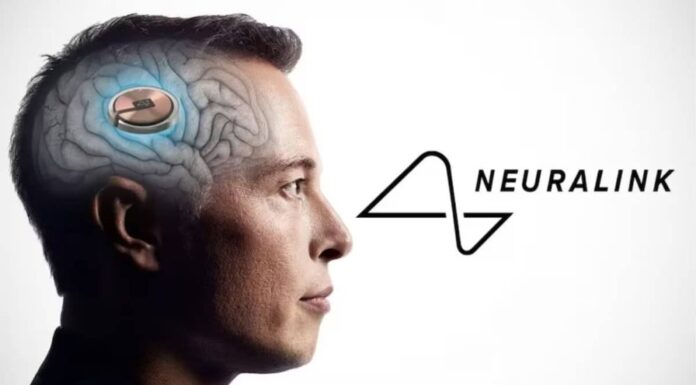 The first human brain implant was completed by Elon Musk’s Neuralink